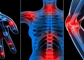 Pse luhatjet e motit rëndojnë reumatizmën, si ta lehtësoni në mënyrë natyrale